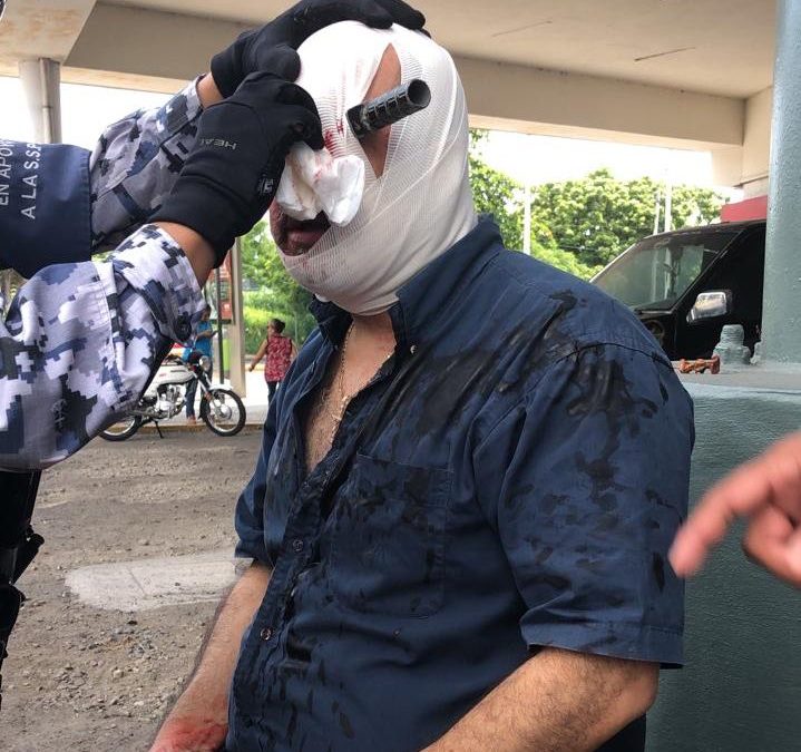 LE CLAVAN CUCHILLO EN LA CABEZA