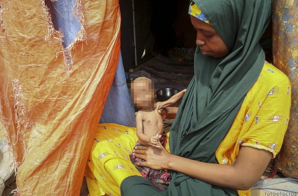 Sequía en Somalia ha cobrado la vida de al menos 200 niños desde enero