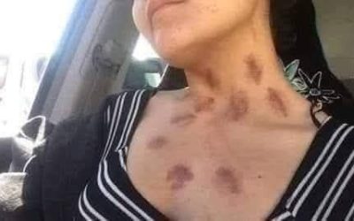 ATACA EL CHUPACABRAS A MUJER CASADA EN LA CIUDAD DE ORIZABA