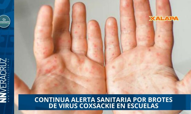 ALERTA SANITARIA EN VERACRUZ POR BROTES DE VIRUS  COXSACKIE EN ESCUELAS 