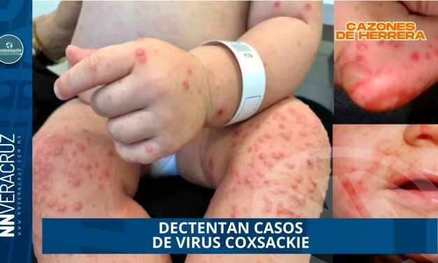 DECTENTAN CASOS DE VIRUS COXSACKIE EN CAZONES DE HERRERA